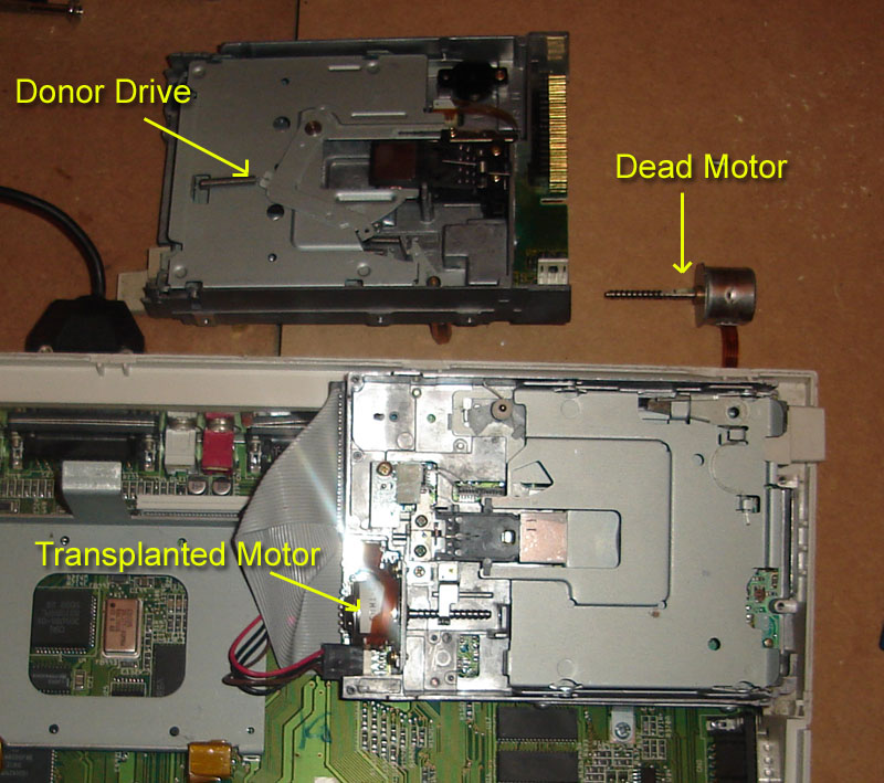 Floppy Drive Heart Surgery